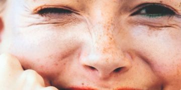Face positivity: H φυσική οµορφιά θα νικήσει!