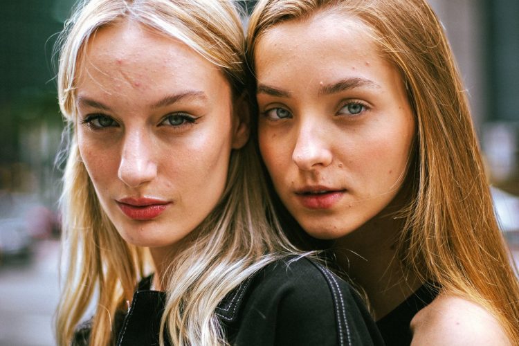 4 βήματα στη skincare ρουτίνα για να εξισορροπήσεις τη λιπαρότητα στην επιδερμίδα σου